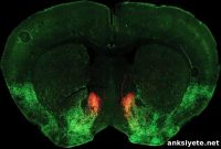 Serotonin Drives Social Aversion in Opioid Withdrawal
