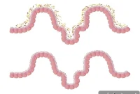 Gut Microbe Linked to Depression Could Lead to Psychobiotic Drugs