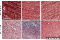 Alzheimer’s Risk Gene Weakens Brain Wiring Insulation