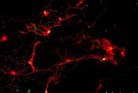 Lab-Grown Retinal Cells Offer New Hope for Blindness