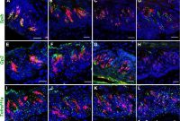 How Taste Cells’ Immune Role Could Help Treat Taste Loss