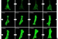 Scientists Discover Key Regulator Behind Huntington’s Disease