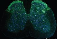 Wearable Microscopes Reveal Spinal Cord Activity in Mice