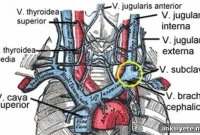 Study: Venous Insufficiency Rare in Multiple Sclerosis Patients
