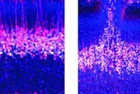 Scientists Discover New Embryonic Brain Circuit