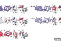 Gene Expression Analysis Improves Brain Disease Classification