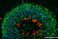 Study Reveals New Gene Linked to Neurodegenerative Diseases