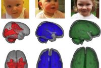 How Breastfeeding Boosts Infant Brain Development