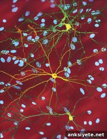 This is a montage of three images of single striatal neurons transfected with a disease-associated version of huntingtin.