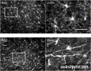 NG2-expressing OPC in healthy and damaged nerve tissue