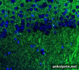 This shows neuron expressions in the amgydala and hippocampus.