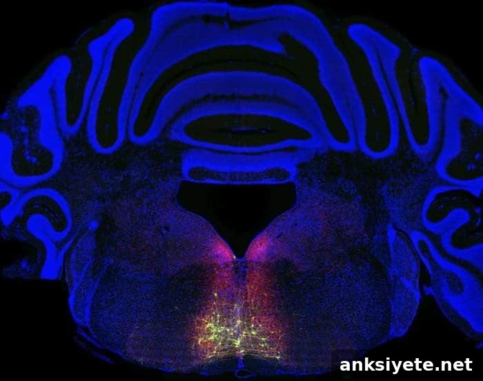 This brain slice shows the RVM.