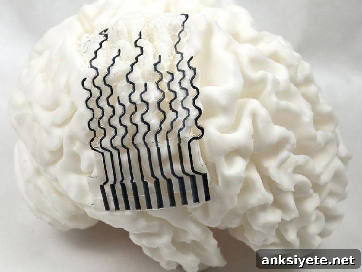 This shows a brain model with the bci on it.