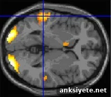 This is the MRI scan associated with the article.