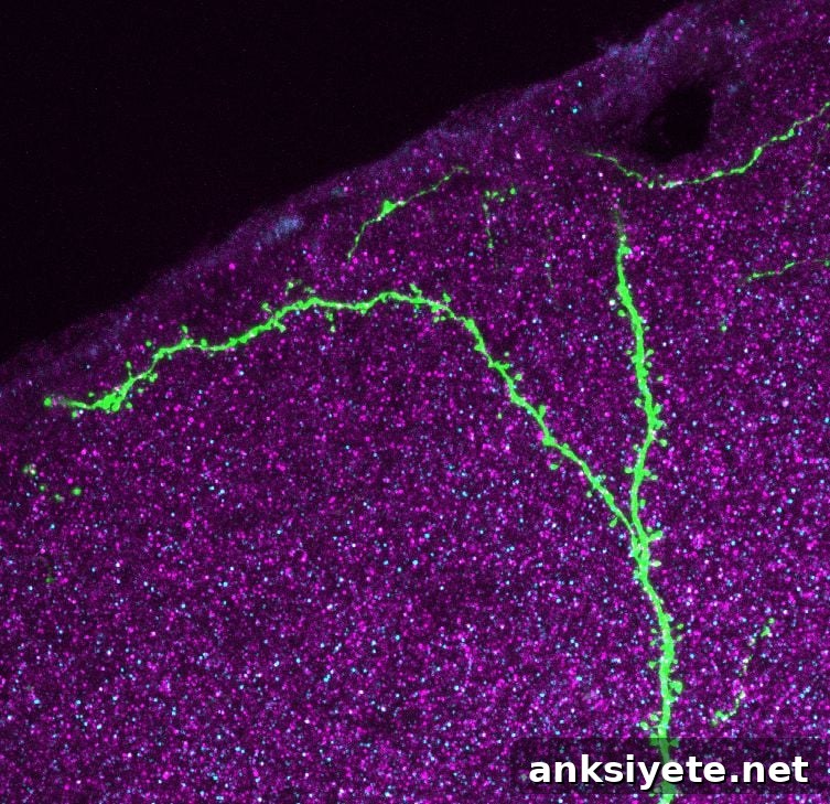 The image shows neurons in the auditory cortex of a mouse