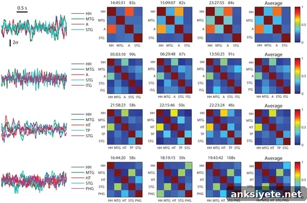 How Brain Connectivity Predicts Epilepsy Surgery Outcomes 2 The image shows the connectivity matrices.