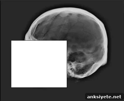 This image shows the skull used in the test.