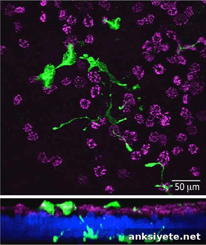 This is a slide of the pulmonary neuroendocrine cells. The caption best describes the image.