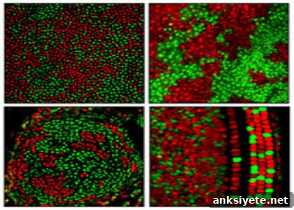 The image shows the silenced and active x chromosomes.