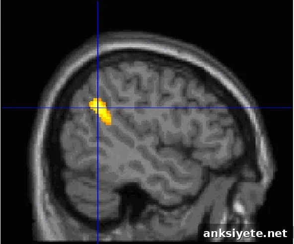 This scan shows the location of the TPJ in the human brain.