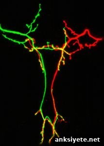 This image shows a highly branched neuron.