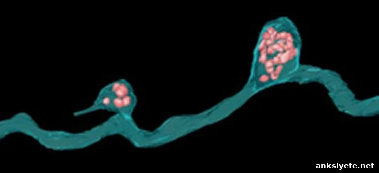 The image shows a retinal ganglion cell.