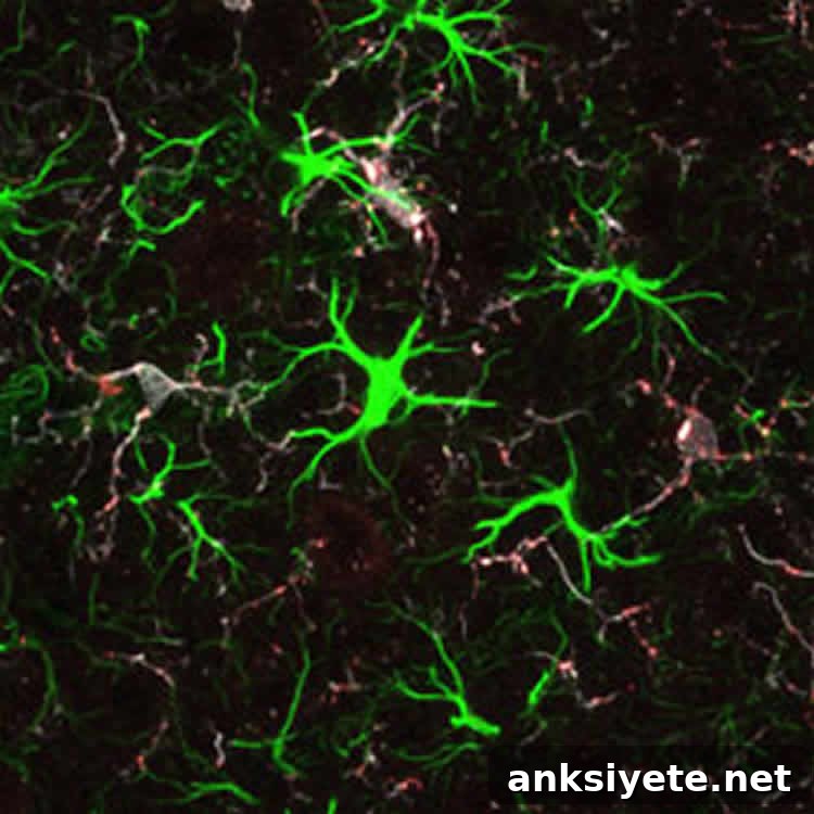 The image shows a brain slice from 5 week old mice with htt.