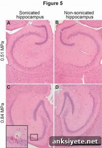 Noninvasive Technique Controls Molecule Size to Cross the BBB 2 The image shows histological brain slices of the hippocampus.