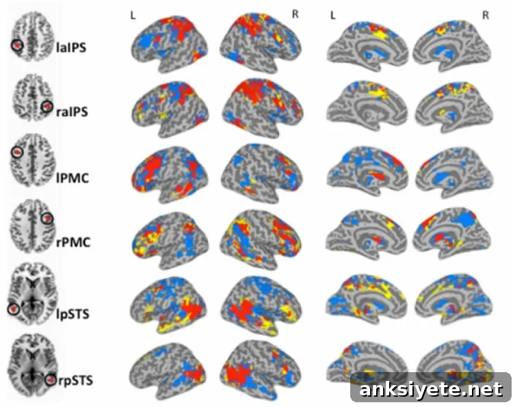 This image shows scans of an autistic brain from a previous study the researcher performed.