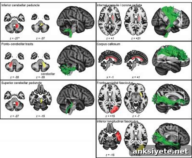 This image shows a range of MRI brain scans from the study.
