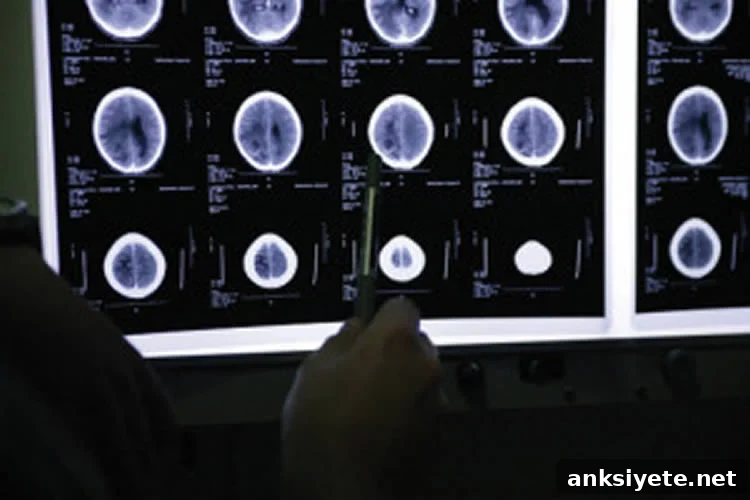Big Data Mining Reveals New Clues to Alzheimer's 2 This image shows brain scans.
