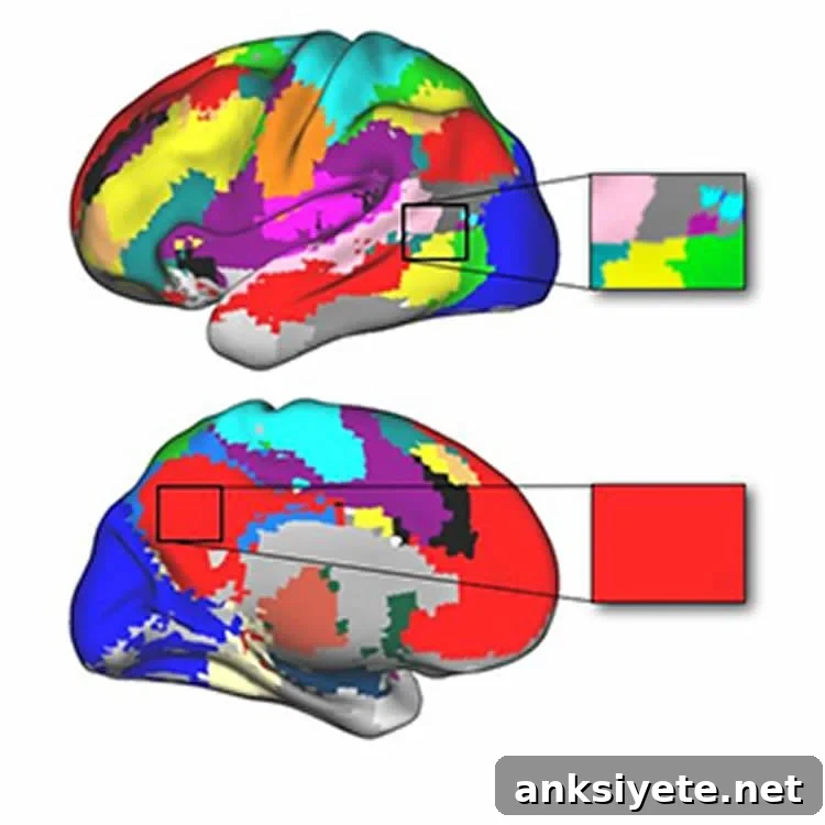 Two brain scans colored to show different networks in the brain