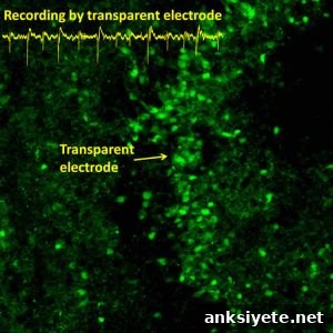 This image shows rat hippocampal neurons through the electrode.