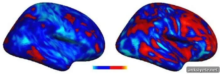 Study Finds Distinct Brain Patterns in Autism 2 This image shows two brain scans which compare the extent of the voxel deviation in people with autism.