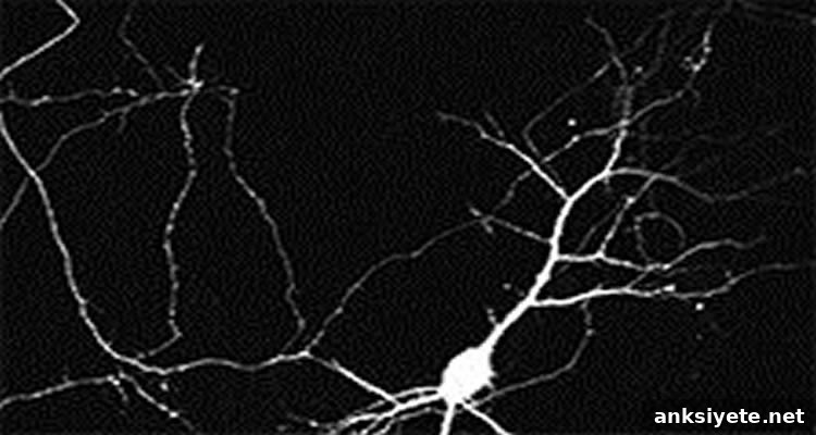 This image shows a neuron.