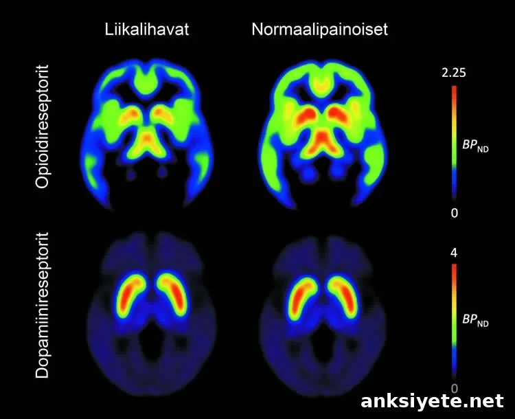 This image shows four PET brain scans associated with this study.