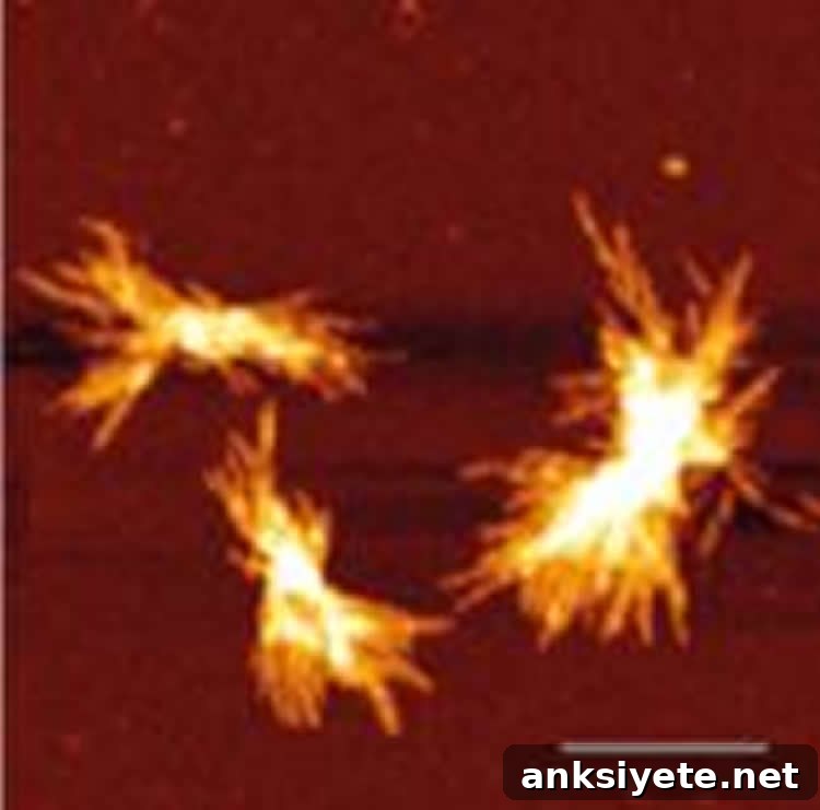 This shows huntingtin protein aggregates.
