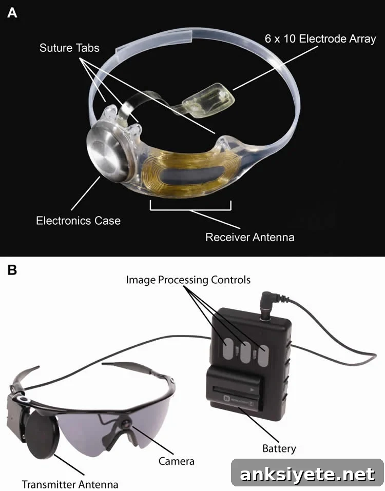 This image shows the Argus 2 system.