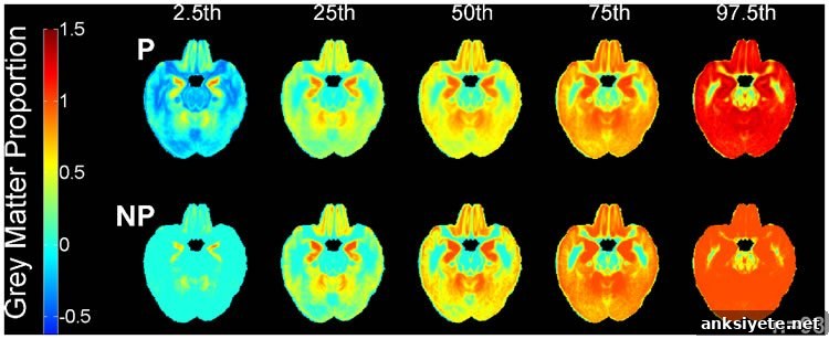 This image shows different brain atlases recorded for the study.