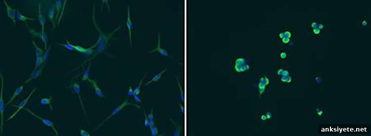 This image shows non-tumorigenic glioblastoma cells.