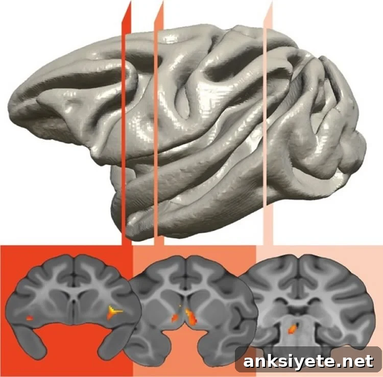This image shows a prefrontal-limbic-midbrain circuit is responsible for the genetic transfer of an anxious temperament.