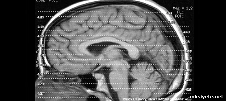 This shows a brain scan.
