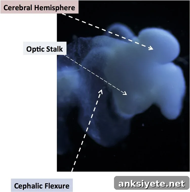 This shows a lab grown brain.