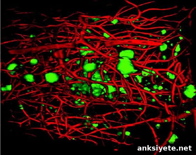 This shows blood vessels and ab plaques.