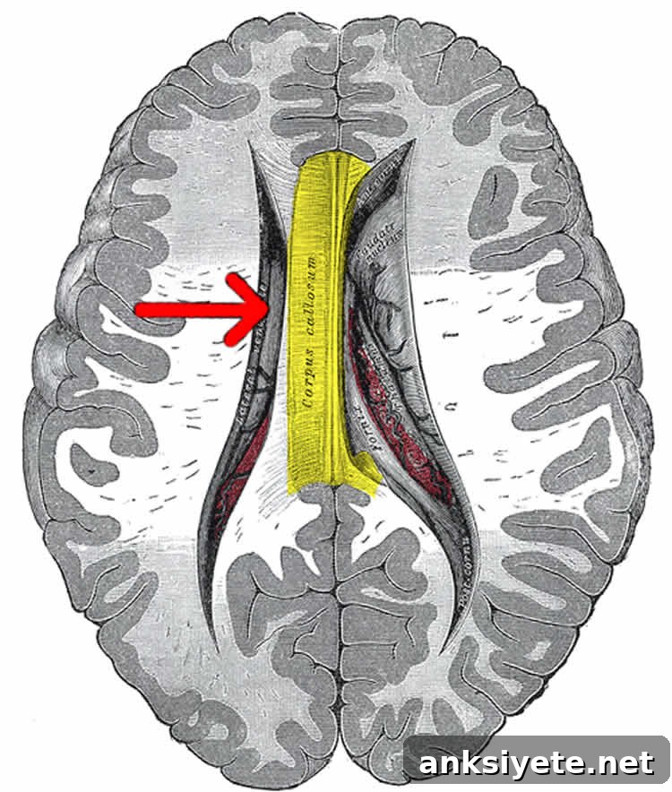 Brain Anatomy Tied to Behavioral Symptoms in Schizophrenia 2 Image shows the location of the corpus callosum in the human brain.
