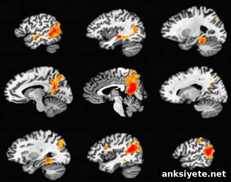 Image shows brain scans from the study. The caption best describes the image.