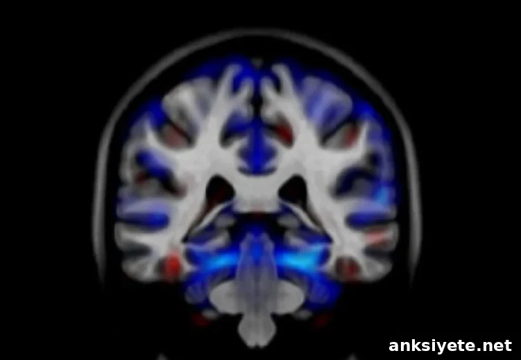 Image shows a brain scan from a person with alcohol dependencies.