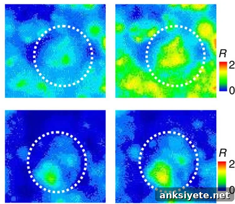 Image demonstrate Ca2+ changes due to SOCE.