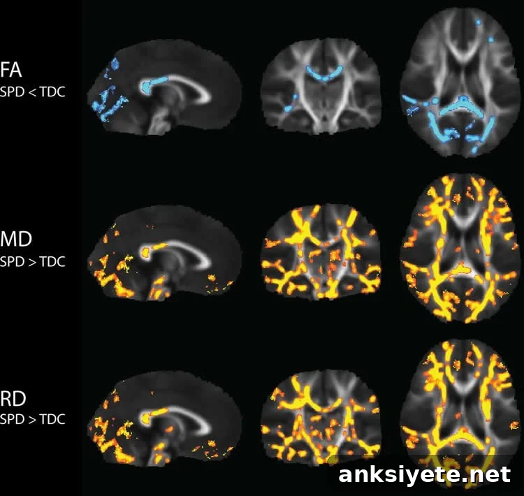 Image shows brain scans from the research.