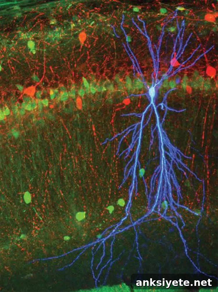 This image shows a stained pyramidal cell.